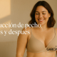 Fotos de reducción de pecho antes y después